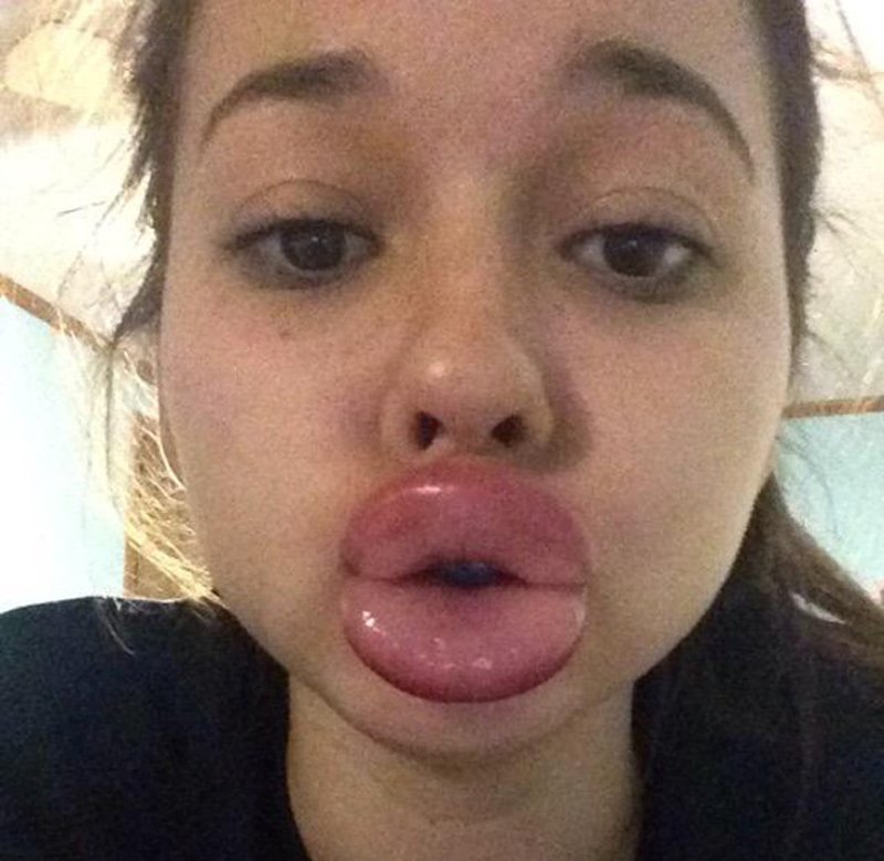 Bloom’s Guide to the Best of the Internet: The Kylie Jenner Lip Challenge